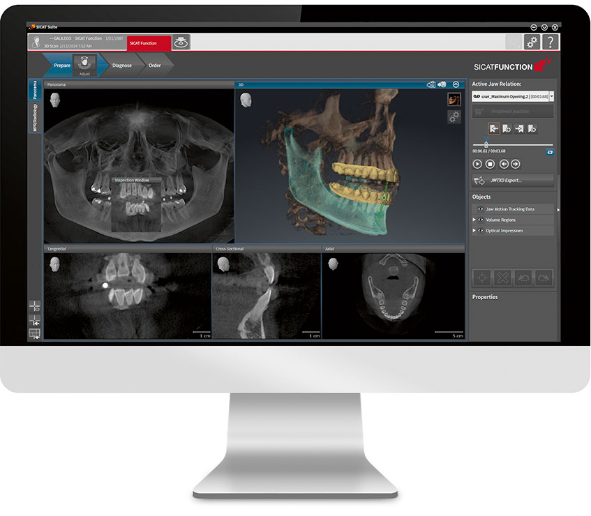 Single Visit Same Day Dental Crown Sioux Falls